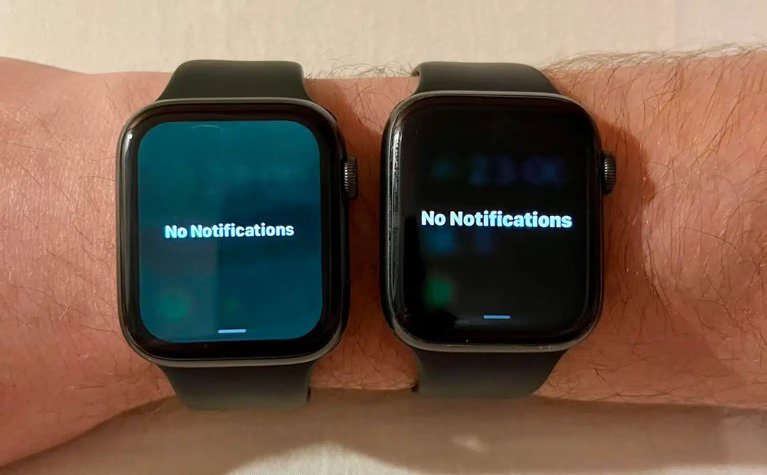 Người dùng apple watch bị hiện tượng “màn hình xanh” sau khi cập nhật watchos 9.5